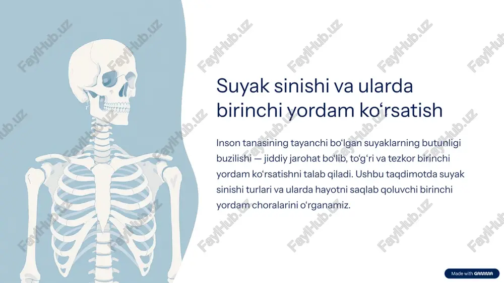 suyak sinishi va ularda birinchi yordam ko‘rsatish — PPTX