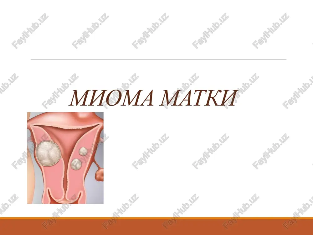 mioma matki,bachadon miomasi — PPTX