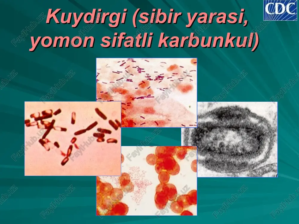 kuydirgi (sibir yarasi, yomon sifatli karbunkul) — PPT