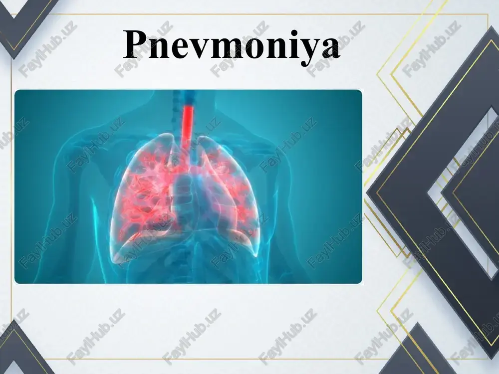 pnevmoniya — PPT