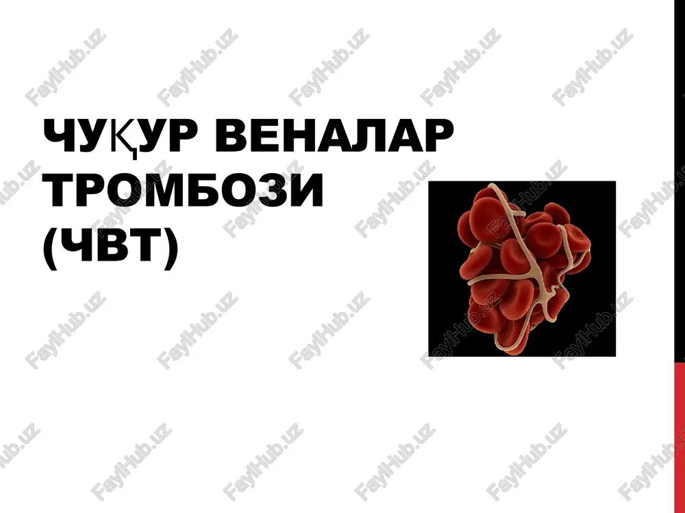 chuqur venalar trombozi(chvt) — PPTX