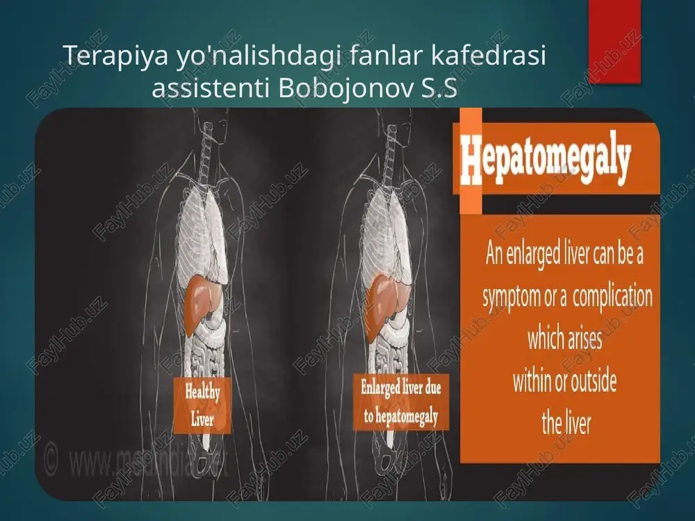 hepatomegaliya — PPTX