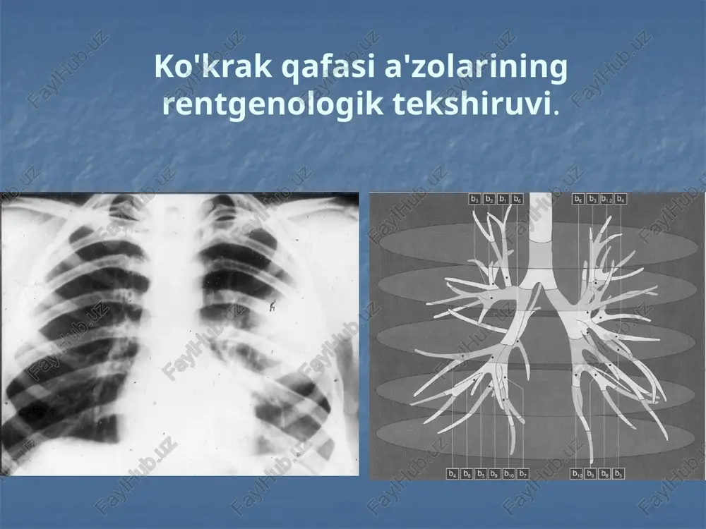 ko'krakqafasia'zolariningrentgenologiktekshiruvi — PPTX