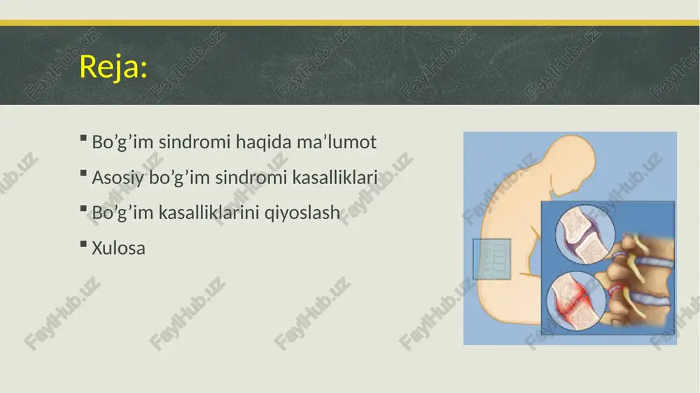 bo’g’im sindromi — PPTX