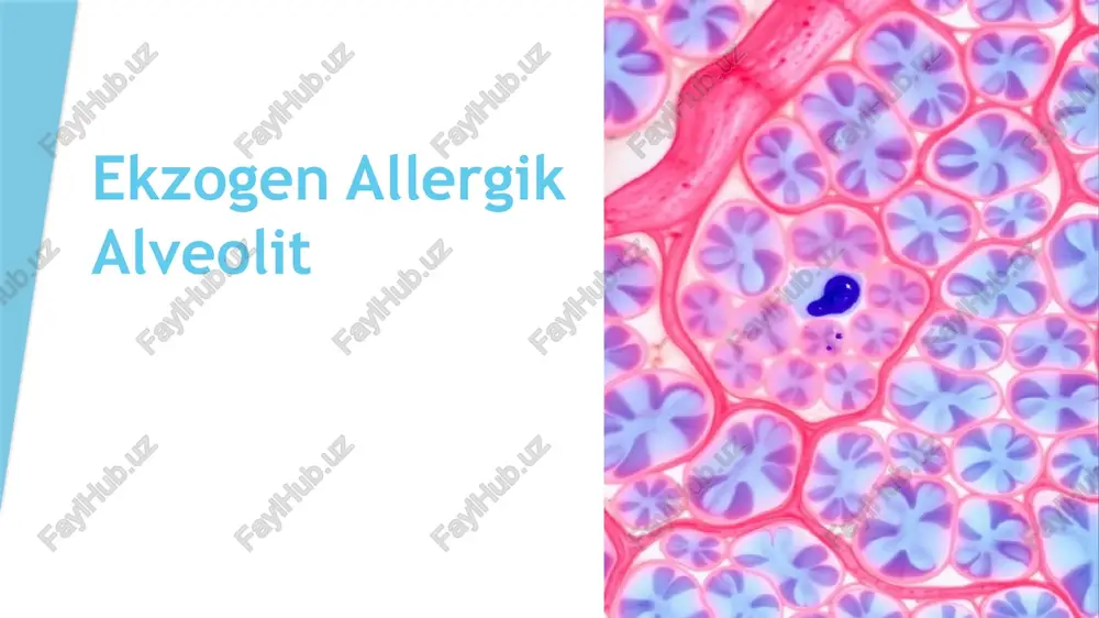 ekzogen allergik alveolit — PPTX
