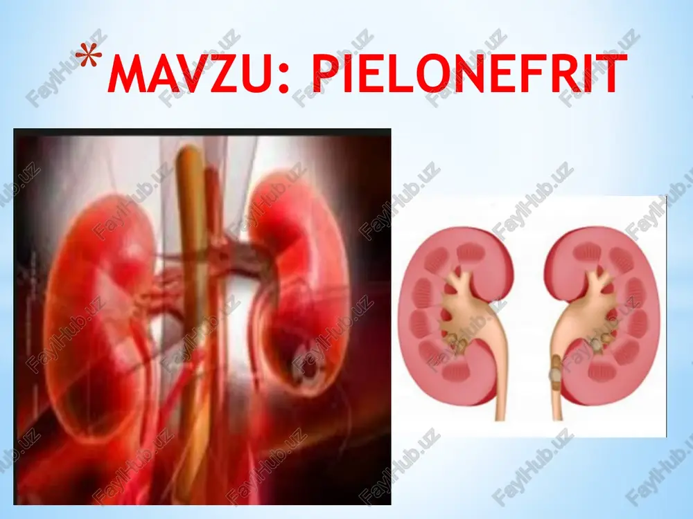 pielonefrit — PPTX