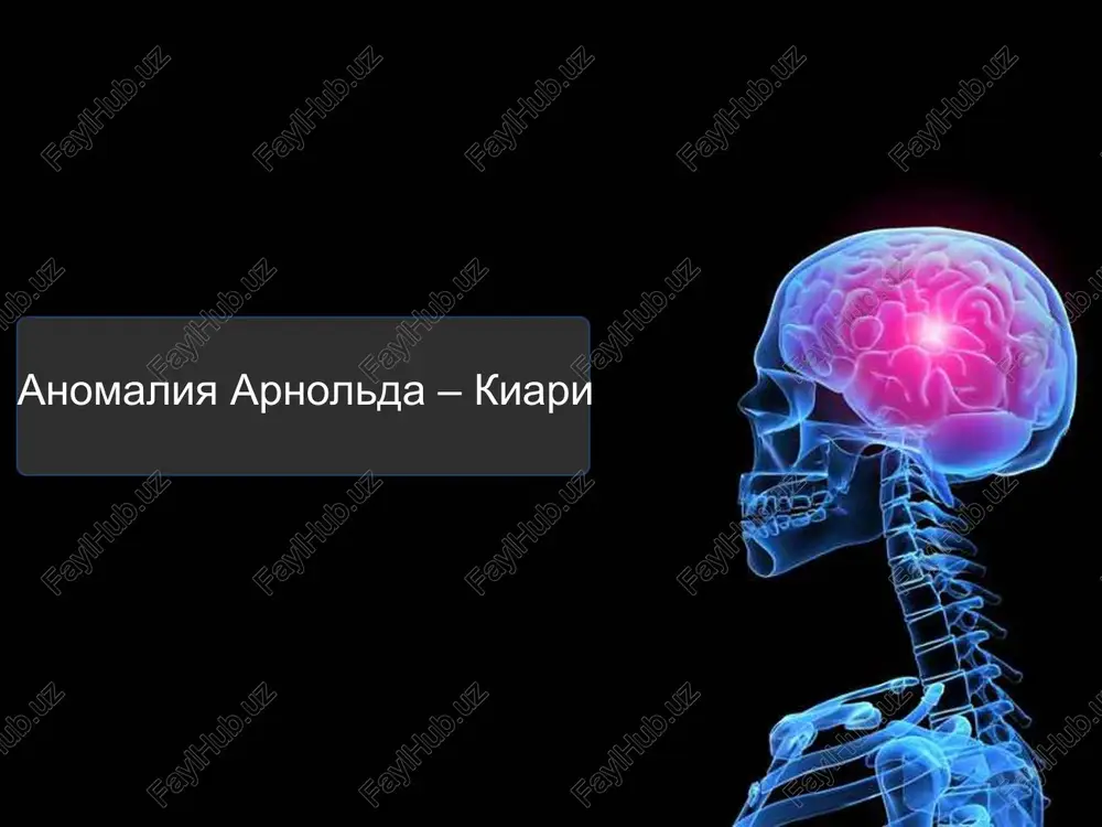 anomaliya arnolda – kiari — PPT