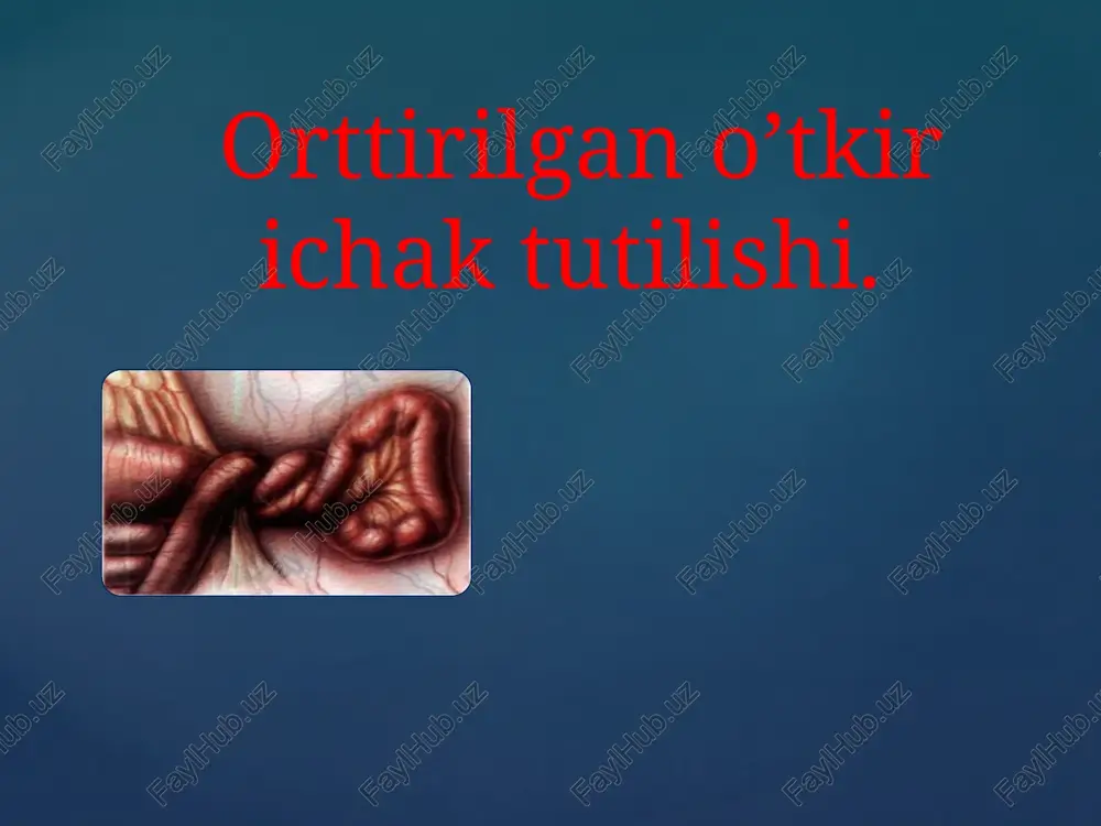 ichak tutilishi — PPTX