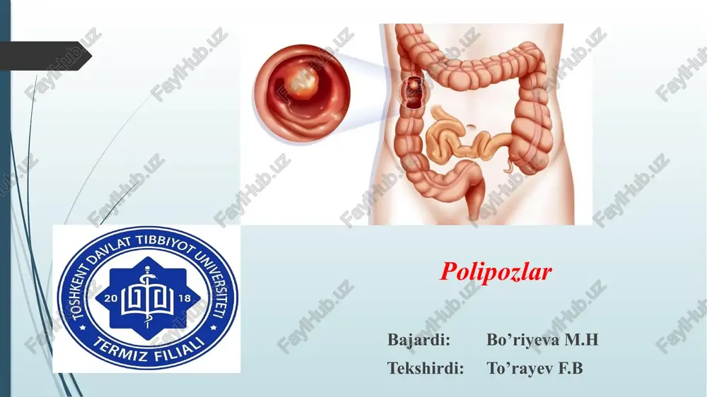 polipozlar — PPTX