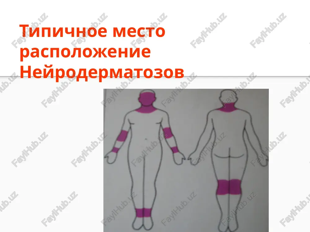 neyrodermatozov — PPTX