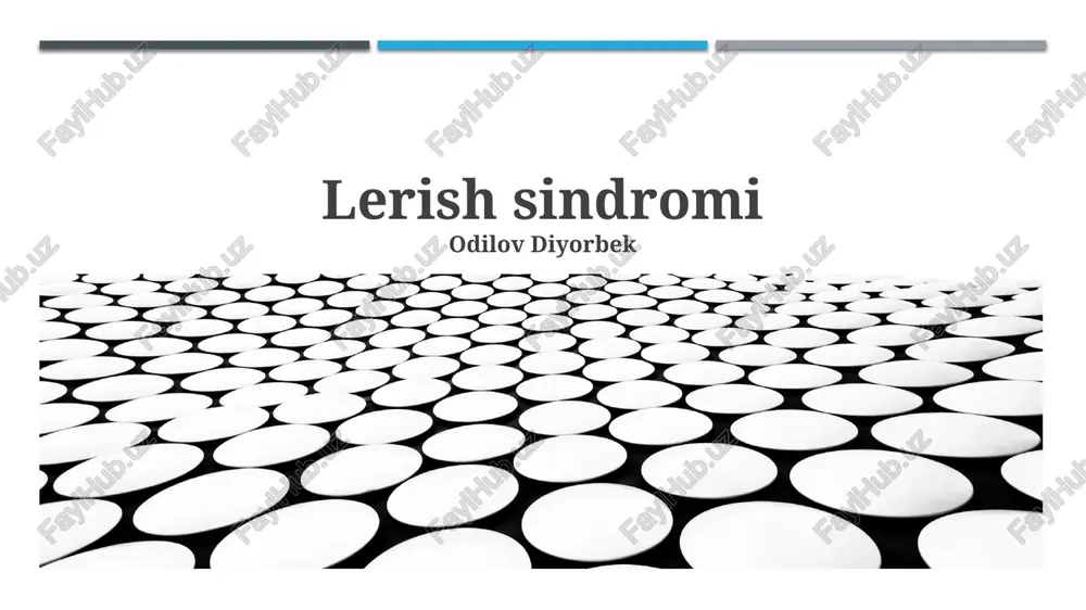 lerish sindromi — PPTX