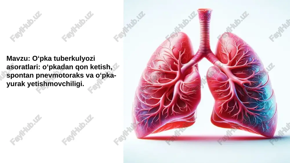 oʻpka tuberkulyozi asoratlari — PPTX