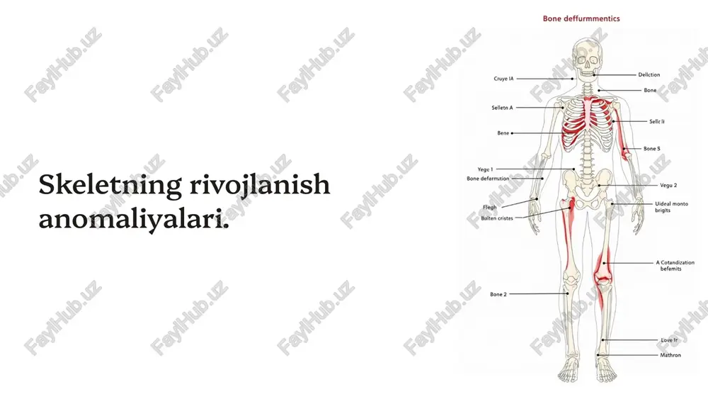 skeletning rivojlanish anomaliyalari — PPTX