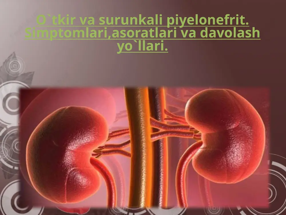 o`tkir va surun kali pielonefrit — PPTX