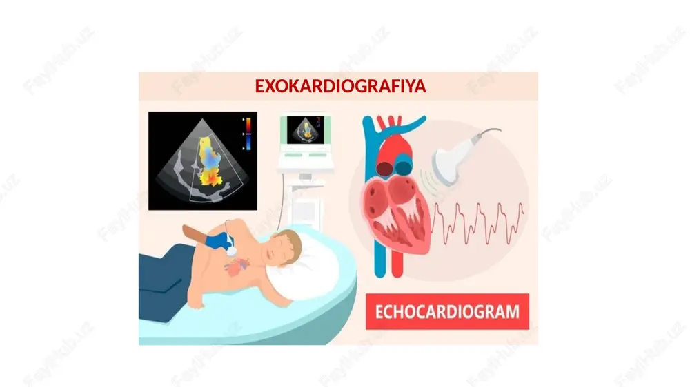 exokardiografiya — PPTX