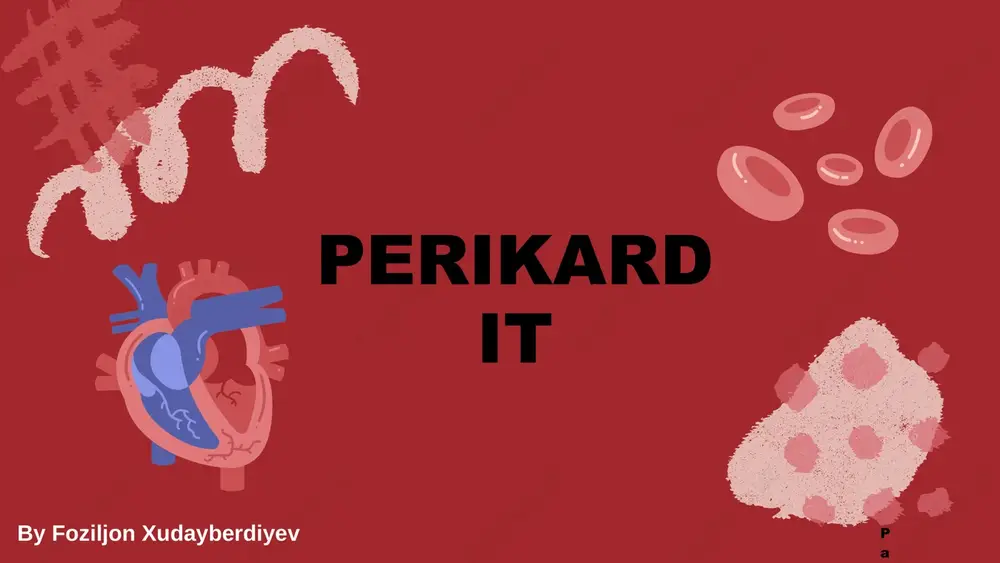 perikardit — PPTX