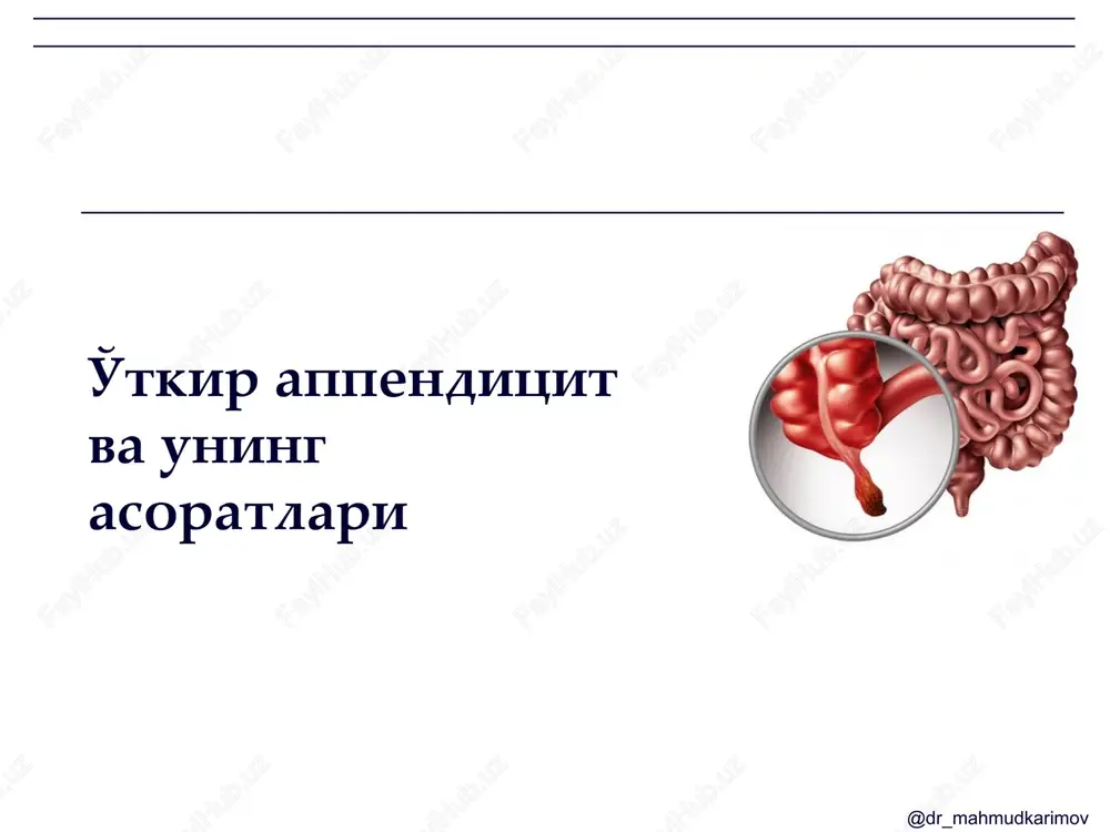 o'tkir appenditsit va uning asoratlari — PPTX