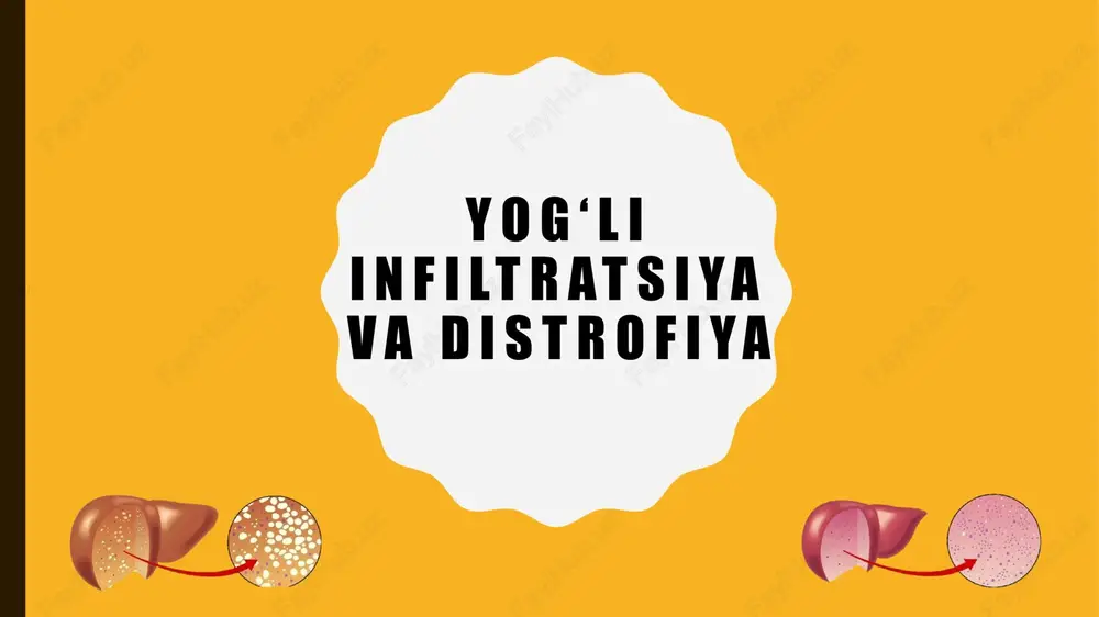 distofiya — PPTX