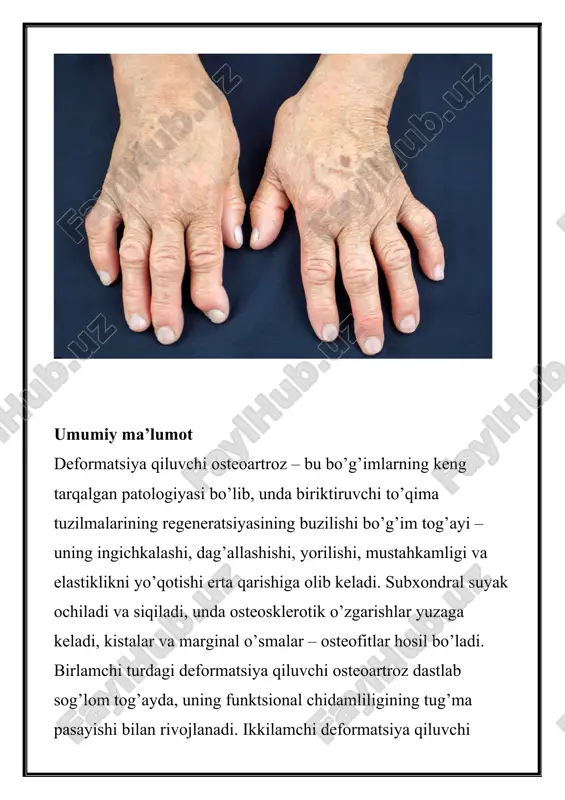 yishi va harakat paytida bo’g’imning siqilishi, mushaklarning o’rtacha atrofiyasi, bo’g’im bo’shlig’ining sezilarli torayishi, suyak to’qimasida sezilarli osteofitlar va subxondral osteosklerozning shakllanishi; · iii – bo’g’imning deformatsiyasi va uning harakatchanligini keskin cheklash, bo’g’im bo’shlig’ining yo’qligi, aniq suyak deformatsiyasi, keng osteofitlar, subxondral kistalar, artikulyar «sichqonchalar» mavjudligi bilan farqlanadi. kellgren va lourens mualliflari radiologik ko’rinishlarsiz deformatsiya qiluvchi osteoartritning 0 bosqichini ajratib ko’rsatishadi. deformatsiyalovchi osteoartroz belgilari deformatsiya qiluvchi osteoartrozning barcha turlari bo’g’imlardagi og’riqlar (artralgiya) bilan tavsiflanadi. og’riqning mexanik turi bo’g’imdagi stress paytida (trabekulyar suyak to’qimalarining mikro sinishi, venoz staz va bo’g’im ichi gipertenziya, osteofitlarning atrofdagi to’qimalarga tirnash xususiyati beruvchi ta’siri, periartikulyar mushaklarning spazmi tufayli) paydo bo’ladi va dam olish paytida yoki tunda susayadi. . «boshlash» og’rig’i qisqa vaqt davom etadi, qo’shma shish va reaktiv sinovitning rivojlanishi natijasida harakatning boshlanishi bilan paydo bo’ladi. bog’imdagi «blokada» og’rig’i davriy xarakterga ega bo’lib, harakat paytida paydo bo’ladi va zararlangan tog’ay («bo’g’im» sichqoncha») bir qismi ikki bo’g’im yuzasi orasiga …