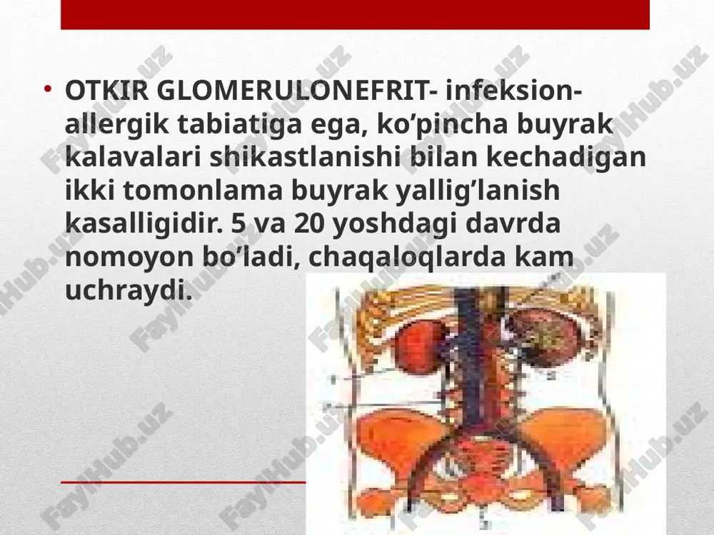 kda oqsil va qon paydo bo’lishi, a\b ko’tarilishi bilan ifodalanadi. shish 2-3 hafta mobaynida kuzatiladi, so’ngra siydik miqdori ko’paya borib a\b pasayadi. ko’pincha surunkali nefritga o’tadi. kasallik asta sekin boshlanadi, sezilar sezilmas hansirash, oyoqlarda shish paydo bo’lishi bilan ifodalanadi. siydik tarkibida o’zgarishlar 2-6 oy davom etadi. diagnostika (infeksiya bilan bog’liq)  o’tkir diffuz glomerulonefrit kasallik yoshlarda uchraydi. surunkali glomerulonefrit qon bosimining yuqori bo’lishi, yurak chap qorincha gipertrofiyasi buyrak funksiyasi o’zgargan, rentgenologik tekshiruv natijasida angioneyroretinopatiya aniqlanishi shishlar, hansirash, gipertoniya siydikda oqsil va eritrotsitlar borligi davosi rejim dieta medikamentoz terapiya yallig’lanish mediatorlorlari va allergiya faolligini to’xtatuvchi preparatlar( nalkrom, dimedrol..) etiotrop antibakterial terapiya (penitsillin guruhi) glyukokortikosteroidlar diuretiklar ( yaqqol shish sindromi va oliguriya) laziks, furasemid 1-3-5 mg\kg\sut 1-2 yuborishda v\i gipotenziv preparatlar: doza individual nosteroid yallig’lanishga qarshi preparatlar. aspirin(tab 0,1; 0,25; 0,5g) ----tomoq, burun qo’shimcha bo’shliqlari, teri streptokokk infeksiyasini va stafilokokkli infeksiyani erta va jadal davolashdan iborat. ----surunkali infeksiya o’choqlarini aniqlash va sanatsiyasi …