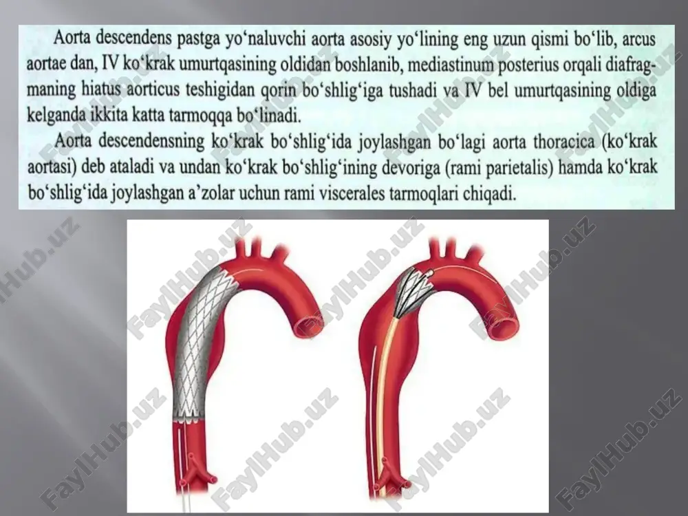 kõkrak va qorin aortasi anatomiyasi pptx - Page 2