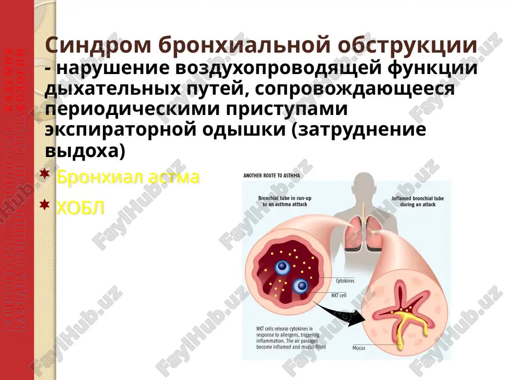 preparatami i bronxolitiki v periodi obostreniy. lechenie provoditsya ambulatorno i lish pri tyajelix obostreniyax tselesoobrazna statsionarnaya terapiya. osnovnie komponenti lecheniya vklyuchayut: obuchenie bolnogo. otsenku i monitorirovanie tyajesti techeniya s pomoshyu pikfloumetrii. kontrol triggernix faktorov, isklyuchenie (eliminatsiyu) provotsiruyushix faktorov. podbor farmakologicheskix sredstv, vklyuchaya bazisnie (protivovospalitelnie) i simptomaticheskie (bronxoliticheskie) preparati v zavisimosti ot tyajesti techeniya (sm. tablitsu). tashkentskaya meditsinskaya akademiya kafedra klinicheskiy farmakologii stupenchataya teraniya bronxialnoy astmi stupet 1 stupet 2 stupet 3 stupet 4 stupet 5 obuchenie patsientov eliminatsionnie meropriyatiya β2-agonisti kortikogo deystviya po potrebnosti varianti podderjivayushey teropii viberite odin viberite odin dobavte odin ili bolee dobavte odin ili bolee nizkie dozi igks nizkie dozi igks + β2-agonist dd srednie ili visokie dozi igks + β2-agonist dd minimalno vozmojnaya doza peraralngo gks alp srednie ili visokie dozi igks alp anti- ige nizkie dozi igks+alp teofillin zamedlennogo visvobojdeniya nizkie dozi igks+tiafillin zamedl. visvob tashkentskaya meditsinskaya akademiya kafedra klinicheskiy farmakologii podbor farmakologicheskix sredstv, …