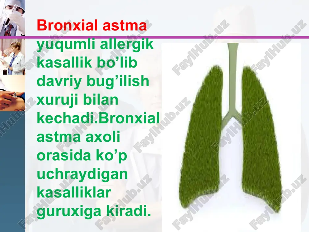 w.themegallery.com patomorfologiyasi: bronxlarda yallig`lanish belgilari, shilliq qavatining shishi, shilliq tiqin, silliq mushaklar giperplaziyasi, bazal membrana qalinlashishi va dezorganizasiyasi aniqlanadi. bronxial astmada endobronxial biopsiyada bronx epiteliysining ko’chishi, shilliq qavat eozinofil infiltrasiyasi ko`riladi. bronxlar yuvindi suvida ko`p miqdorda epitelial, semiz xujayralar, eozinofillar va limfositlar topiladi. www.themegallery.com klinikasi: www.themegallery.com shikoyatlar va anamnez ekspirator xansirash va/yoki yo`tal xurujlari masofadan xushtaksimon xirillashlar eshitilishi ko`krak qafasida og`irlik xissi ob’ektiv ekspirator xansirash burun kataklarini nafas olganda kengayishi quzg`alish nafas aktida qo`shimcha mushaklar ishtiroki majburiy xolat perkussiyada: emfizema shakllanganda qutisimon perkutor tovush auskultasiyada: qurug` xushtaksimon va g`o`ngillovchi xirillashlar xamda nafas chiqarish fazasining uzayishi bronxial astmaning tasnifi asosiy patogenetik variantlari g.b.fedoseev tomonidan to’ldirilgan tasnif bo’yicha: www.themegallery.com infeksion-bog`liq atopik autoimmun disgormonal disovarial asabiy-ruxiy adrenergik disbalans xolinergik jismoniy zo`rig`ishdagi astma aspirin astmasi (triada) bronxial astmaning kechish darajalari: www.themegallery.com engil kechishi-yilida 2-3 marta xuruj o`rtacha og`irlikda kechishi-yilida 3-4 marta xuruj-shifoxonada davolanib yuradi. og`ir kechishi-xuruj tez-tez yilida 5 martadan ko’p kuzatiladi. davolash : …