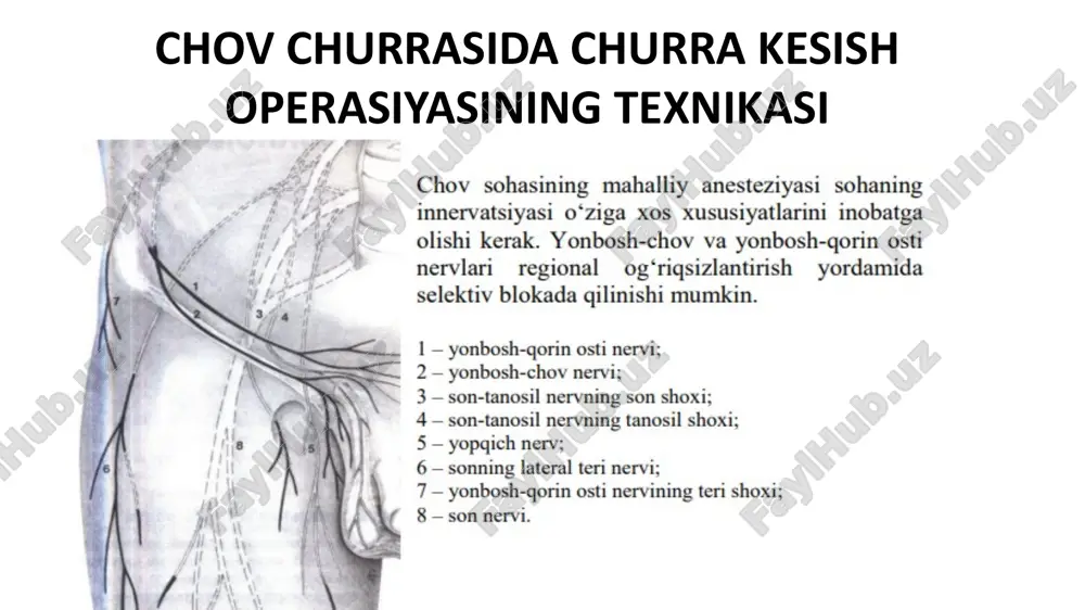 ng ikkita tutami qisqichlar orasida kesiladi (kremasterni rezeksiya qilish), va cho‘ltog‘i ligaturalar bilan bog‘lanadi urug‘ tizimchasiga o‘rnatilgan ushlagichni sekinlik bilan traksiya qilish orqali, va zarurat bo‘lganda churra xaltasini dyuval qisqichi bilan ushlab olish, churra xaltasini urug‘ tizimchasidan va ko‘ndalang fassiyadan o‘tkir va tumtoq yo‘l bilan sekin-asta ajratish imkonini beradi (churra xaltasining disseksiyasi). bitishmalar ko‘p bo‘lganida va noaniq vaziyatlarda churra xaltasini aynan shu disseksiya vaqtida kesib ochish tavsiya etiladi. churra xaltasi bo‘yinchasining disseksiyasi: churra xaltasini disseksiya qilish ko‘ndalang fassiyadagi nuqsongacha davom etilishi kerak. agar qiyshiq chov churrasida nuqson chov kanalining ichki halqasida joylashgan bo‘lsa, bunda uni to‘liq ajratib olish kerak bo‘ladi. urug‘ chiqarish yo‘li va urug‘ tizimchasi venalarini identifikatsiyalash uchun urug‘ tizimchasi disseksiyasini chov kanalining ichki halqasigacha davom ettirish lozim. churra xaltasi chov kanalining ichki halqasidan har tomondan ajratib olinadi va ko‘ndalang fassiya bilan bog‘langan bitishmalardan ozod qilinadi. urug‘ tizimchasining tashqi (kremaster) venalarini kesish: pastki qorin osti venalariga quyiladigan tashqi kremaster …