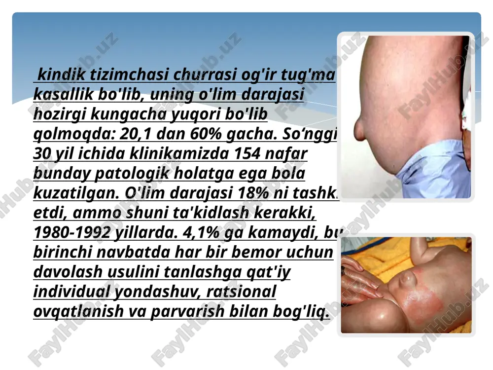 zilgan kulrang amniotik membranalar bilan qoplangan. tug'ilgandan keyingi dastlabki soatlarda membranalar shunchalik shaffofki, siz churraning tarkibini ko'rishingiz mumkin: jigar, ichak qovuzloqlari, oshqozon va boshqa organlar. ba'zi joylarda parda qalinlashadi, odatda churra xaltasining yuqori qismida to'plangan varton jelesi notekis taqsimlanadi. kindik tomirlarining (bir vena va ikkita arteriya) kirish joyida zich dumaloq truba paypaslanadi. amniotik membranalar to'g'ridan-to'g'ri qorin old devorining terisiga "churra halqasi" ning chetiga o'tadi. o'tish chizig'i 2-3 mm gacha kenglikdagi yorqin qizil rangga ega (teri kapillyarlarining uzilish zonasi). ba'zi hollarda teri 1,5-2 sm balandlikdagi halqa shaklida churraning tagiga cho'ziladi. ("ulkan oyoq").kindik tizimchasining kichik churralari ba'zan kattalashgan kindik tizimchasiga o'xshaydi. tug'ruqxonada bolani beparvo tekshirganda, bunday "kindik ichakchani" u erda joylashgan ichak halqalari bilan bog'lab qo'yish mumkin. kichik churralarning tarkibi ichakdan iborat bo'ladi. bunday yangi tug'ilgan chaqaloqlarning umumiy holati azoblanmaydi. o'rta kattalikdagi churralar sezilarli miqdordagi ichak qovuzloqlari bilan to'ldiriladi va jigarning bir qismini o'z ichiga olishi mumkin. bolalar odatda klinikaga og'ir ahvolda, …
