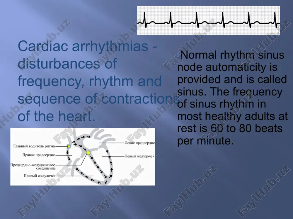 heart disease, heart disease, pericarditis, acute myocardial infarction, chronic lung disease, anemia, etc.) nadjeludochkovie narusheniya ritma prohibited tea, coffee, nicotine, alcohol, spicy foods, overeating, taking sympathomimetics. when neurogenic tachycardia shown sedatives and tranquilizers. important rehabilitation of chronic foci of infection (caries). when ch is carried optimal digitalization, treatment of the underlying disease process. drugs of choice are β-blockers. due to the blockade of β1-adrenergic receptors, inhibits automatism and slows conduction velocity, and lengthens the effective refractory period. intrinsic sympathomimetic activity competes to some extent with β-adrenoceptor blocking properties, reducing the negative inotropic effect fibrilloflutter ventricular rate fails to control with digoxin, beta-blockers and verapamil. to restore sinus rhythm can use synchronized electrical cardioversion. an alternative is the use of amiodarone for the restoration of sinus rhythm and amiodarone or sotalol for its retention. approach to the prevention of complications tromboembolicheskoh atrial flutter is the same as at anadolu medical center. …