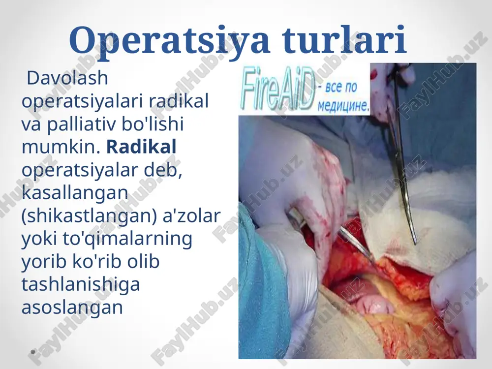 shi); 4) iflos yoki birlamchi kasallik yuqtiruvchi operatsiyalar. bemorni ruhan tayyorlash . xirurgik operatsiya ruhiy jihatdan sog'lom kishilarda u yoki bu darajada ruhan ezilishiga sabab bo'ladi. buni bartaraf etish yoki kamaytirishning uddasidan chiqilsa, bemorni operatsiyaga tayyorlashga ham, operatsiyadan keyingi natijalarga ham yaxshi ta'sir ko'rsatadi xirurgik operatsiyani o'tkazish jarrohlik yo'li bilan davolashni to'g'ri amalga oshirish uchuk katta ahamiyatga ega bo'lgan operatsiya xonasidagi ishlarni tashkil etish haqida ham gap boradi xirurgik operatsiya bir nechta bosqichdan iborat: 1) bemorni operatsiya stoliga yotqizish; 2) operatsiya maydonini tayyorlash; 3) og'riqsizlantirish; 4) operatsiya qilishga kirishish; 5) operatsiyani amalga oshirish 6) operatsiyani tugatish. bemorni operatsiya stoliga yotqizish hamma narsa operatsiyaga layyorlangan, operatsiya stoli ustiga kleyonka va toza choyshab yozilgandan so'nggina bemor operatsiya xonasiga olib kiriladi operatsiyada qo’llaniladigan asboblar skalper turlari va uni ushlash yonboshlab yotish holati buyrak yoki ko'krak qafasida operatsiya amalga oshirilganda qo'llaniladi. ginekologik holatdan to'g'ri ichak, prostata bezi, tashqi jinsiy a'zolar va qin operatsiya qilinganda …
