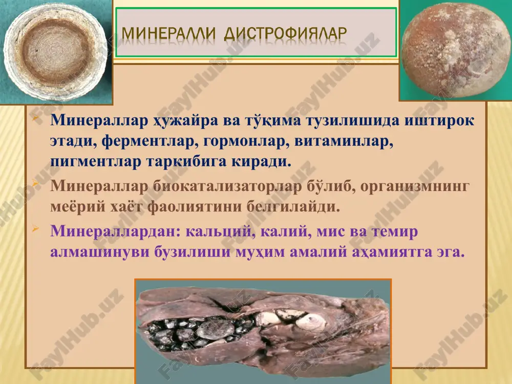 , zich, kulrang-sariq tusdagi nekrozdir. 2) kollikvatsion nekroz – suyuqlikga boy to'qimalarda, nekrozning erishi va kista paydo bo'lishi bilan namoyon bo'ladi. 3) gangrena – tashqi muhit bilan aloqasi bor to'qimalarda, xavo va bakteriyalar ta'sirida qon pigmentlarining temir sulfidga aylanishidan qora rangga kiradi va kuygan jismni eslatadi (gangrena –kuyish degani). 4) sekvestr – autolizga uchramaydigan qattiq to'qima nekrozi (suyak, tog'ay, pay). 5) infarkt – tashqi muhitdan holi,ichki a'zolar ishemik nekrozi. 6) fibrinoid nekroz – biriktiruvchi to'qima va tomir devori nekrozi. 7) suzmasimon nekroz – silga xos quruq, kazeoz nekroz. 8) yotoq yara – uzoq yotganlardagi teri nekrozi. 9) ateromatoz nekroz – arteriya devoridagi bo'tqasimon nekroz. 10) elimsimon nekroz – zaxm gummasidagi elimsimon nekroz. 11) apoptoz – umrini yashab bo'lgan hujayra genli dasturli nekrozi. 1) koagulyatsion nekroz 2) kollikvatsion nekroz tsenker nekroz sildagi nekroz ishemik infarkt 3) gangrena 4)sekvestr noma sekvestr gangrena 5) infarkt taloq yurak yurak chandig'i yurak anevrizm ichak o'pka …
