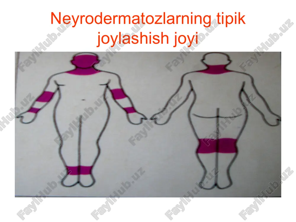 neyrodermatozlar tasnifi - Page 2