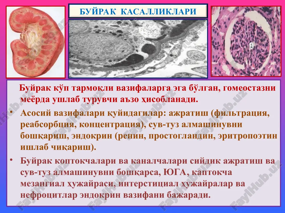 tsinozli tubulopatiya. interstitsial kasalliklari: 1) tubulointerstitsial nefrit, 2) pielonefrit. buyrak kasalliklari -glomerulopatiyalar glomerulonefrit glomerulonefrit, bu – infektsion-allergik tabiatli, ikki tomonlama, buyrak kaptokchalarining yiringsiz yallig'lanishli, buyrakka xos va buyrakdan tashqaridagi simptomlar bilan kechuvchi kasallikdir. buyrakka xos simptomlariga proteinuriya, gematuriya, tsilindruriya, oligouriya; buyrakdan tashqarilariga – shish, arterial gipertenziya, yurak gipertrofiyasi, disproteinemiya, giperazotemiya, uremiyalar kiradi. tasnifi. 1) kechishi bo'yicha: o'tkir, avj oluvchi va surunkali; 2) joylanishi bo'yicha: intrakapillyar va ekstrakapillyar; 3) yallig'lanishi bo'yicha: ekssudativ, proliferativ, aralash; 4) kaptokchalarning shikastlanish darajasiga ko'ra: diffuz va o'choqli glomerulonefritlar farq qilinadi. buyrak kasalliklari etiologiyasi. gemolitik streptakokkning nefritogen shtammi, lekin stafilakokk, pnevmokokk, viruslar (gepatit v), oqish trepanema, bezgak plozmodiysi ham sabab bo'lishi mumkin. quyidagi infektsion kasalliklardan: angina, skarlatina, orvi, pnevmoniya, meningokokkli infektsiya, bezgak, bakterial endokardit, zaxmdan keyin ikkilamchi kasallik ko'rinishida rivojlanadi. patogenezi. ikkita immunopatologik mexanizm mavjud: 1) kaptokchalar kapillyarlari bazal membranasiga qondagi eruvchan immun birikmaning o'tirishi, leykoxemotaksis, neytrofil leykotsitlar faollashuvi, ularning lizosomal fermentlari bazal membranani lizislashi va yallig'lanish …