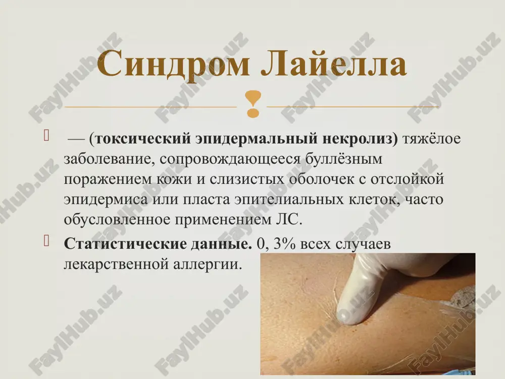 em povishennogo davleniya ego soderjimogo) klinika porajenie slizistoy obolochki polosti rta, nachinayushegosya s aftoznogo i razvivayushegosya do nekrotichesko-yazvennogo stomatita porajenie polovix organov (vaginit, balanopostit) gemorragicheskiy (s perexodom v yazvenno-nekroticheskiy) kon'yunktivit — naibolee rannee proyavlenie zabolevaniya virajennaya obshaya simptomatika s narastayushey intoksikatsiey, vizvannoy poterey jidkosti i belka cherez porajyonnie erozirovannie poverxnosti, narusheniem vodno-solevogo balansa, razvitiem infektsionnix porajeniy (chasto pnevmoniy, vtorichnogo infitsirovaniya koji), krovotecheniem iz jkt vplot do letalnogo isxoda. klinika vajnimi diagnosticheskimi kriteriyami yavlyayutsya: • tyajeloe obshee sostoyanie bolnogo (visokaya temperatura, sputannost soznaniya i t.d.) • rezkaya boleznennost porajennoy i zdorovoy koji • polojitelniy simptom nikolskogo • simptom smochennogo belya • otsutstvie eozinofilii v klinicheskom analize krovi, uvelichenie kolichestva palochkoyadernix neytrofilov, toksicheskaya zernistost neytrofilov. diagnostika sindroma layela. taktika vedeniya bolnie podlejat obyazatelnoy gospitalizatsii v reanimatsionnoe otdelenie ili blok intensivnoy terapii bolnix vedut kak ojogovix (jelatelna «ojogovaya palatka») v maksimalno sterilnix usloviyax, chtobi ne dopustit ekzogennogo infitsirovaniya primenyaemie do razvitiya sindroma ls …