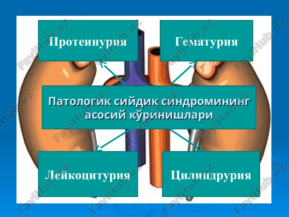gandan keyin yo'qoladi. funktsional (fiziologik) proteinuriya dimlanishli yurak kasalliklarida uchrab, kuniga 1-3 g dan oshmaydi, lekin uni xar doim xam funktsional xarakterli deb bulmaydi. funktsional (fiziologik) proteinuriya ortostatik (lordotik, postdural) koptokchali ayrim hollarda 13-20 yoshdagi, astenik tana tuzilishiga ega bo'lgan yoshlarda uchrab, gorizontal xolda yo'qoladi (kuniga 1 g gacha). ularning ertalabki siydik tahlilida oqsil aniqlanmaydi patologik proteinuriya manbai bo'yicha prerenal (to'yingan) renal (koptokchali va kanalchali) postrenal (buyrakdan tashqari, yolg'on ko'rinishi) yuzaga keltiruvchi mexanizmiga ko'ra glomerulyar (koptokchali), tubulyar, aralash, to'yingan (“overflow“), sekretor proteinuriya gisturiya prerenal yoki to'yinish proteinuriya mielom kasalligi, valderstrem makroglobulinemiyasi, tomir ichi gemolizi, monotsitar leykoz kabi kasalliklarda plazmada ko'p miqdorda to'planib, qonda aylanib yurgan kichik molekulyar og'irlikka ega bo'lgan oqsillarni buyrak koptokchalarining shikastlanmagan devoridan filtrlanish, miqdorining ko'pligi sababli to'liq so'rilmasligi yoki ularni reabsorbtsiyasi uchun zarur bo'lgan fermentni yo'qligi tufayli umuman so'rilmaydi. tarkibi: immuno-globulinlarning engil zanjirlari -bens-jons oqsili, mioglobin, gemoglobin, mezotsimlar miqdori: kuniga 0,1 -20 g gacha buyrak kanalchalarini immunoglobulinlarni …