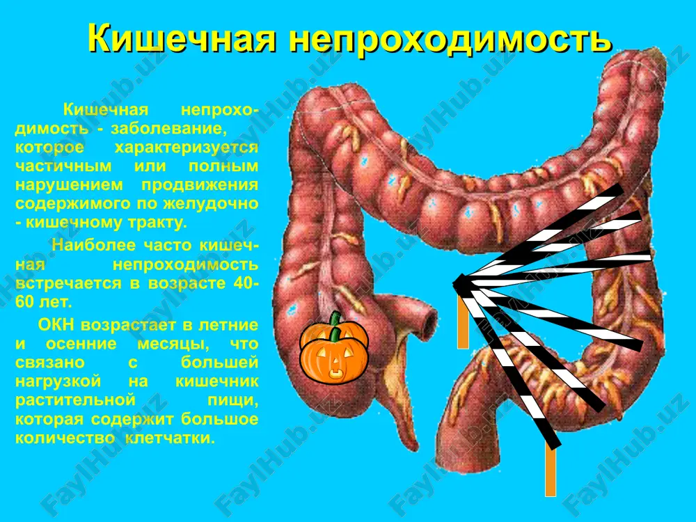 onit prichini spasticheskoy neproxodimosti pechenochnaya kolika askaridoz pochechnaya kolika stress prichini spasticheskoy neproxodimosti gipoprotei- nemiya uremiya avitaminozi atsidoz * rplm prichini mexanicheskoy neproxodimosti strangulyatsionnaya kishechnaya neproxodimost spaechnie protsessi uzloobrazovanie invaginatsiyu zavorot kishki mexanicheskaya neproxodimost obturatsionnaya kishechnaya neproxodimost inorodnie tela jelchnie kamni rubtsovie strikturi klubok askarid mexanicheskaya neproxodimost obturatsionnaya kishechnaya neproxodimost tuberkulez kishechnika sdavlenie kishki snaruji opuxoli drugix organov opuxol kishechnika obshaya simptomatologiya, diagnostika ostroy kishechnoy neproxodimosti. kvadrat simptomov toshnota i rvota vzdutie jivota zaderjka stula i gazov bol kvadrat simptomov toshnota i rvota vzdutie jivota bol ischeznovenie boli ili zaderjka stula i gazov kvadrat simptomov vzdutie jivota zaderjka stula i gazov bol toshnota i rvota zaderjka stula i gazov est net vremya bol zaderjka stula i gazov kvadrat simptomov toshnota i rvota vzdutie jivota rvota net est vremya diagnosticheskiy algoritm a. sbor anamneza b. ob'ektivniy osmotr bolnogo 1. obshiy osmotr 2. ob'ektivniy osmotr jivota a) ad oculus b) osmotr grijevix …