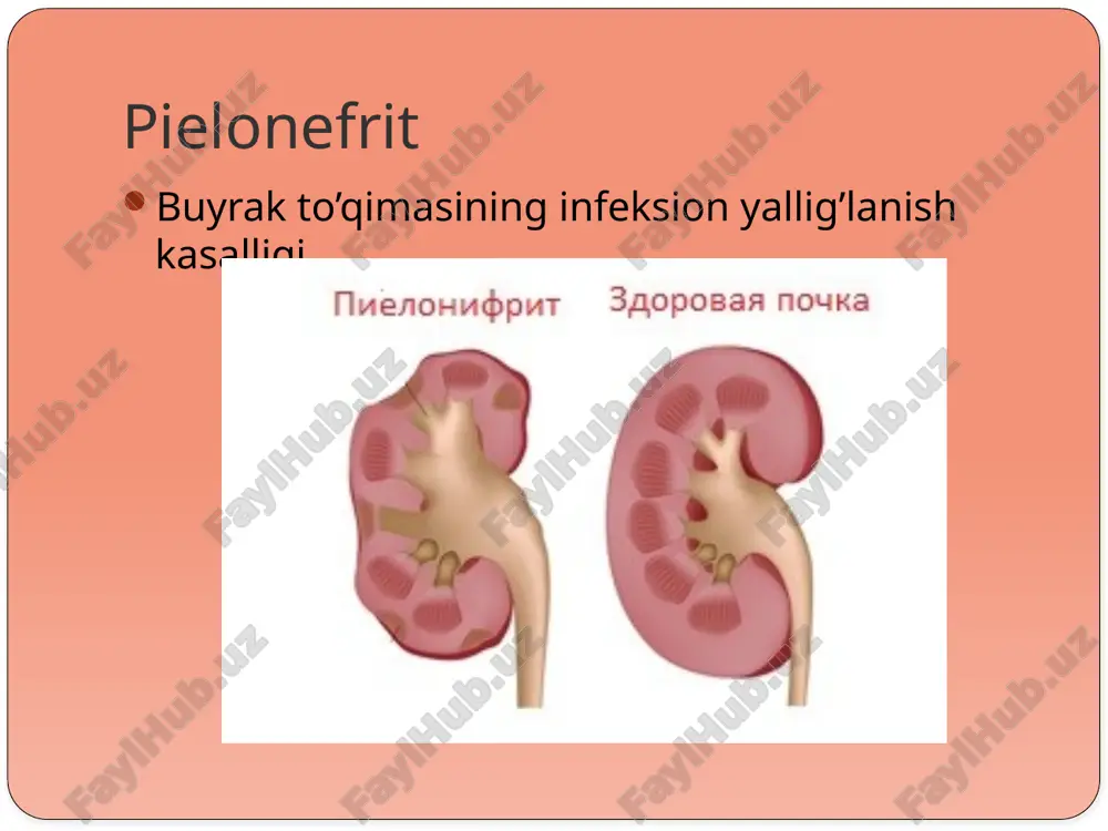 cht oshishi, biokimyoviy tahlilda esa s-reaktiv oqsilni paydo bo'lishi, utt buyrak naychalarining kengayishi va jomchalar deformatsiyasi, keyinroq buyrak parenximasi qalinligining kamayishi kuzatiladi. ekskretor urografiyada ham yuqoridagi o'zgarishlar va musbat xodson sindromi aniqlanadi. instrumental: ekskretor urografiya buyrak hajmi assimetriyalashishi buyrak parenxemasi yupqalashishi kosacha – jom tizimi deformatsiyasi kontrast moddaning notekis ajralishi rentgenoskopiya utt pielonefritda kosachalar deformatsiyalanishi va kengayishi mumkin pielonefritda abstsess va karbunkul xosil bulishi mumkin surunkali pielonefrit davolash. surunkali piyelonefritni qo'zish davrida bemorlarni davolashda antibiotiklar yetakchi o'rin egallaydi va yengil kechishida boshlang'ich muolajalar ambulatoriya, o'rtacha og'irlikdagi va og'ir kechishlarida shifoxona sharoitida o'tkaziladi. birinchi kunlari yotoq tartibi, ko'p miqdorida suyuqlik ichish (bemorda shishlar ko'zatilmasa) va yuqori kaloriyali ovqatlar buyuriladi. 577 shuningdek, piyelonefrit tashhisiga shubha bo'lgan kundan boshlab keng spektr ta'sirga ega bo'lgan antibiotiklar va uroseptiklar buyuriladi. surunkali piyelonefritni chaqirgan mikroblar va ularni antibiotiklarga sezuvchanligi aniqlangandan so'ng mazkur guruhdagi antibakterial dorilar monand dozalarda buyuriladi. kasallik kechishining og'ir yoki yengilligidan kelib chiqib, antibakterial …