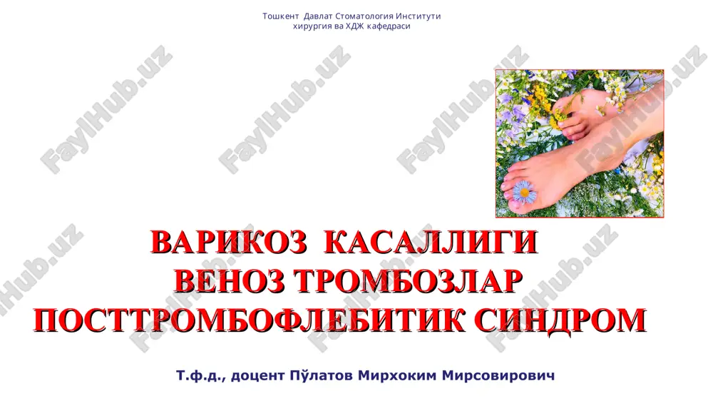 eleangioektaziya, retikulyar varikoz i utib ketuvchi shishish, varikoz transformatsiya ii turg'un shishish, giperpigmentatsiya, lipodermoskleroz, ekzema iii indurativ tsellyulit, trofik yara, ikkilamchi limfedema sear klassifikatsiyasi (slinical etiological anatomical pathophysiological,1994) klinik kurinishi 0 – kasalik belgilari kurinmaydi i – teleangioektaziyalar, retikulyar varikoz ii – varikoz venalar iii – shishish iv – trofik uzgarishlar v – trofik uzgarishlar + yopiq yara vi – trofik uzgarishlar + ochiq yara etiologiya birlamchi ikkilamchi anatomichesk segment yuzaki venalar chuqur venalar patofiziologiya reflyuks okklyuziya reflyuks va okklyuziya v 1994 godu gruppa amerikanskogo venoznogo foruma sozdala klassifikatsiyu sear * kurik * davolash xirurgik endovaskulyar flebosklerozlovchi tarix otto wilhelm madelung (1846-1926) madelung operatsiyasi (1884) tarix 1888 y. – troyanov 1890 y. – trendelenburg aleksey alekseevich troyanov (1848-1916) friedrich trendelenburg (1844-1924) tarix 1906 g. – narat william wayne babcock (1872-1963) albert narat (1864-1924) 1907 g. – bebkokk tarix 1938 y. – robert linton 1955 y. – d.felder 1985 y. – …