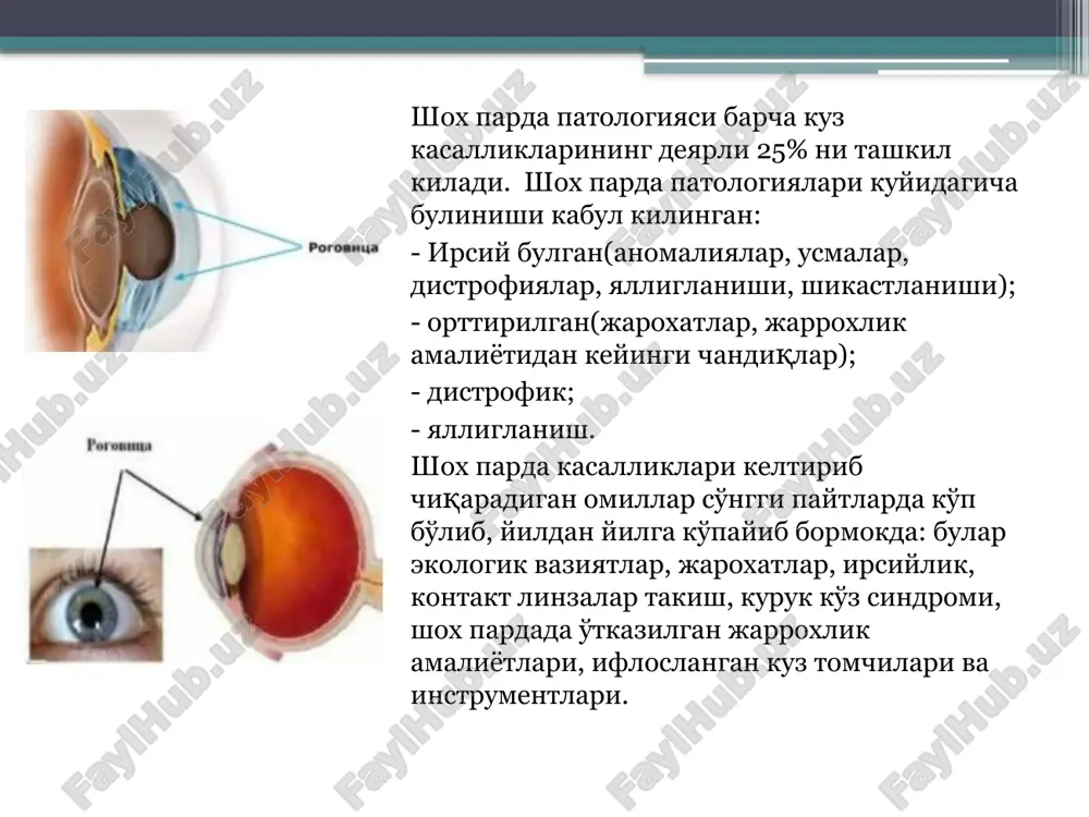 l kasalligi – shox pardani lentasimon ikki taraflama progressiyalanuvchi epitelial-stromal distrofiyasi (nospetsifik infektsion poliartrit) kurinishida namoyon bo'ladi bullez keratit (pufaksimon keratit) –shox pardani trofikasini chukur buzilishi (termal glaukomada kuzatiladi) kayzer-fleysher pigment xalkasi – bu shox parda periferik kismida jigarrang pigmentni eg'ilishi (psevdoskleroz, vilson kasalligi) shox parda epitelial-endotelial distrofiyasi – kontakt zonasida endoteliy shishi va shox parda xattoki epiteliysigacha xiralashishi kuzatiladi (shishasimon tana yoki sun'iy gavxargrijasini shox parda endoteliysi bilan kontakti kuzatiladi, bu shox parda teshib o'tuvchi jaroxatida, katarakta ekstraktsiyasi shishasimon tana chikib ketganda, iol implantatsiyasidan keyin kuzatiladi) shox parda yalliglanishi - keratitlar keratit — ( yunon. keros – shox.) -shox parda yalliglanishi bo'lib, uning xiralashishi va ko'pincha ko'rish o'tkirligini pasayishi bilan kechadi. keratitlar klassifikatsiyasi b a k t e r i a l : stafilo-, strepto-, pnevmo-, diplokokkli sil zaxm bezgak, brutsellez ii. v i r u s li adenovirusli gerpetik kizamik, chechakli iii. i n f e k ts …