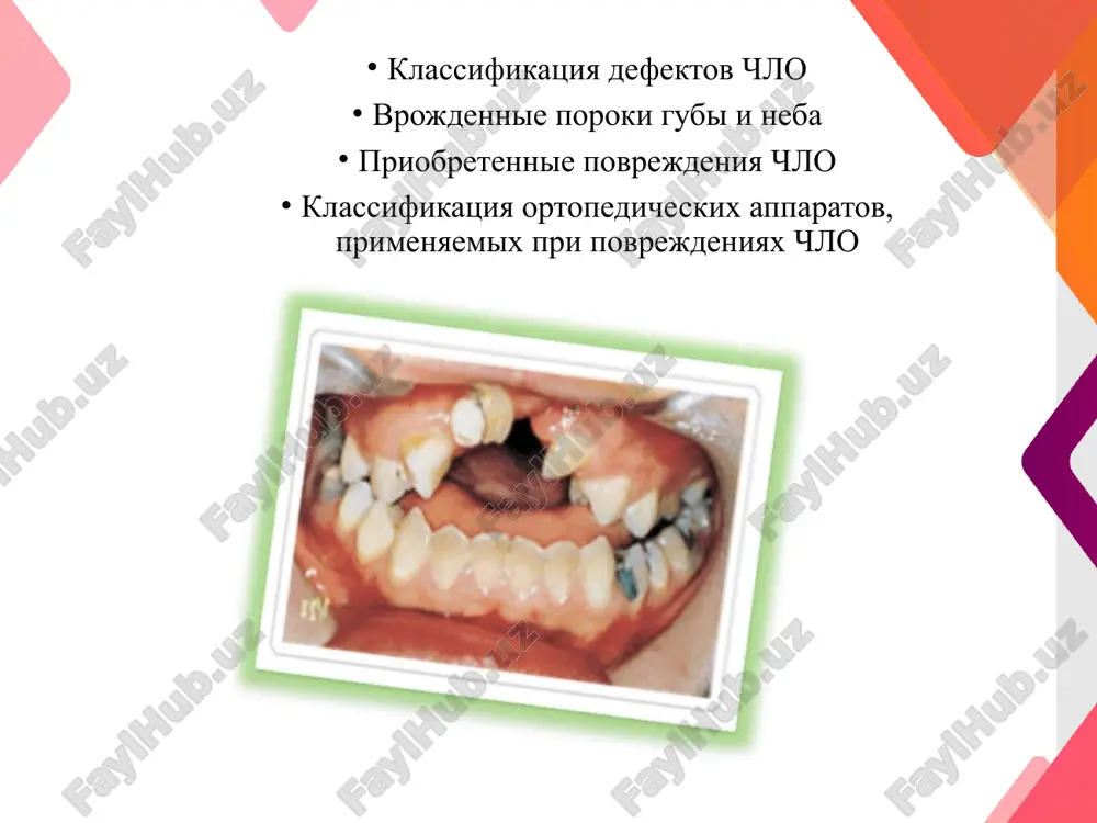 anomaliy: mutantnie geni / + vliyanie vrednix faktorov, vozdeystvuyushix na plod v kriticheskie periodi razvitiya togo ili inogo organa. * gipoksiya ploda, ostrie avitaminozi i virusnie zabolevaniya (krasnuxa, kor, gripp) materi na rannix stadiyax beremennosti. gametopatii blastopatii embriopatii fetopatii (blastozi) narushenie v blastotsitoze, printsip «vse ili nichego». poroki, voznikshie v rezultate povrejdeniya embriona, t.e. ot 16-go dnya posle oplodotvoreniya do kontsa 10 ned. beremennosti. period organogeneza i maksimalnoy chuvstvitelnosti. povrejdeniya ploda, voznikayut ot 11 nedeli beremennosti do rodov. period xarakterizuetsya v osnovnom rostom i uvelicheniem razmerov organov, krome gm i potovix jelez. teratogeni v etot period, kak pravilo, ne privodyat k virajennim porokam razvitiya. primerom mojet slujit diabeticheskaya fetopatiya. bolshinstvo vpr formiruyutsya imenno v etot period tak kak proisxodit osnovnaya zakladka vsex organov i tkaney (diabeticheskaya, talidomidnaya embriopatiya, embriopatiya vsledstvie virusa krasnuxi) virajennie teratogennie vozdeystviya v etot period razvitiya chashe vsego pri vodyat k gibeli zarodisha do ustanovleniya fakta beremennosti …