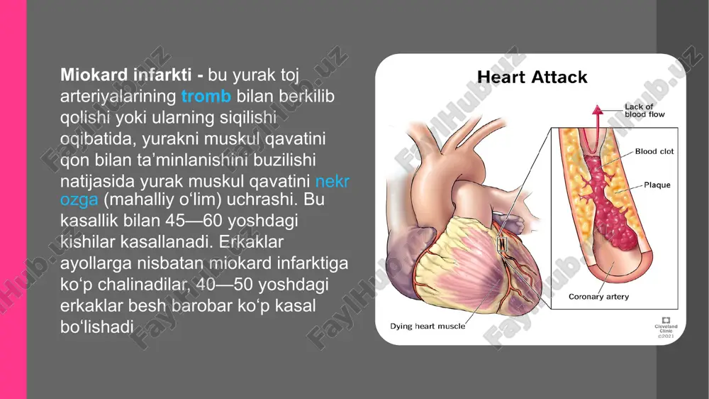 ekrozning joyiga qarab infarkt quyidagicha ataladi: miokard infarkti asosan yurak sohasida bo‘ladigan qattiq og‘riq bilan boshlanadi.og‘riq kuchli bo‘ladi. bemor ko‘pincha chidolmaydi.og’riq xatto qo’l va qo’l uchlarida ham sezilishi mumkin. obyektiv maʼlumotlar: bemoring rang-ro‘yi oqaradi, terisi nam, sovuq ho'l bo’lib terlaydi. yurak urishi bir daqiqada 100-120 marta bo'lishi mumkin. arterial qon bosimi kasallikning boshlanishida birinchi kuni ozroq ko‘tariladi, keyin pasayadi. yurak tonlari bo‘g‘iq eshitiladi. miokard infarktining katta-kichik o'choqligiga qarab bemorning tana harorati 37-38° c gacha ko‘tariladi. miokard infarktida yurakning mushak tolalari o‘rnida har xil nekrozga uchragan moddalar hosil bo'lib , qonga so‘riladi. bunga javoban badanda yalligianishga xos jarayon rivojlanadi (qonda leykotsitlar, fermentlar ko‘payishi). miokard infarktining gastralgik xili miokard infarktining qorin bo‘shlig‘i aʼzolari kasalligiga xos belgilari bo’lgan (gastralgik) xili qorinning yuqori qismida og‘riq, koʻngil aynishi, qusish, kekirish, hiqichoq tutishi, qorinning dam boʻlishi, ich ketishi bilan kechadi. qorin sohasida paydo bo’lgan og‘riq kurakka, kuraklar oraligʻiga, to‘sh oldi qismiga tarqaladi, bemorning umumiy ahvoli yomonlashadi, …