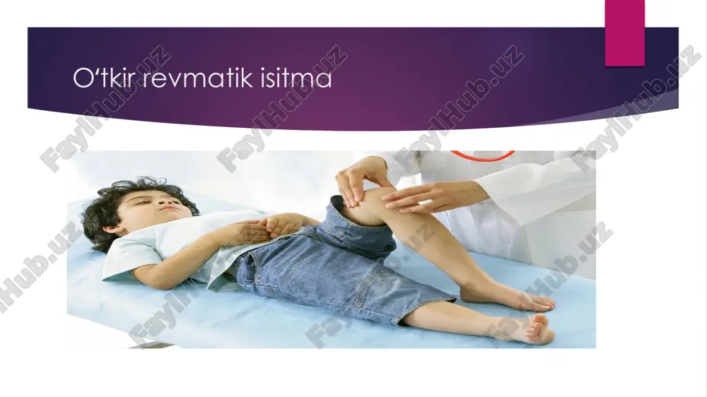 rak zararlanishiga, balki asoratlar rivojlanishiga ham olib keladi». β-gemolitik streptokokk oʻtkir revmatik isitma patogenezi o’ri rivojlanishi zamonaviy nazariyasiga ko’ra ri toksik-immunologik kasallikdir. streptokokk kardiotoksik fagositozni to’xtatish, membra-nalar va biriktiruvchi to’qimani zararlash xususiyatiga ega bo’lgan moddalar ishlab chiqaradi. bular m-protein, peptidoglikan, streptolizin – o va s, gialuronidaza, streptoki-naza, dezoksiribonukleaza va boshq. strepto-kokk va miokard to’qimalari o’rtasida o’zaro immunologik bog’liqlik mavjud. streptokokk toksinlari yurak-qon tomir tizimi va biriktiruvchi to’qimada yallig’lanish chaqiradi. streptokokk va yurak o’rtasidagi antigen o’xshashlik autoimmun mexanizm rivojlanishiga – miokard va biriktiruvchi to’qimaga nisbatan autoantitanalar ishlab chiqarilishiga olib keladi. gumoral va hujayraviy immunitet buzilishi asl-o, asg, ask, disimmuniglobulinemiya, b-limfositlar miqdori oshishi va t- limfositlar miqdori kamayishi bilan ifodalanadi, bazofillar faoliyati buziladi, gistamin, serotonin, bradikinin kabi yallig’lanish mediatorlari ishlab chiqariladi. immun yallig’lanish jarayoni biriktiruvchi to’qimani zararlaydi. patomorfologik ko’rinishi asosiy omil biriktiruvchi to’qimaning, birinchi navbatda yurak va tomirlarning birlamchi zararlanishidir. o’ri rivojlanishida biriktiriuvchi to’qima zararlanishining 4 bosqichi farqlanadi: klinika kasallik boshlanishi belgilari …