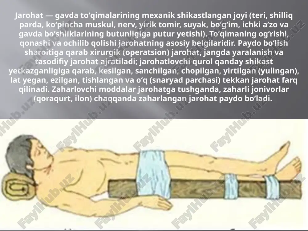 tlanishi, bunda tashqi kuch ta'sirida bo'g'im ligamentlarining haddan tashqari cho'zilishi sodir bo'ladi va odatda ligamentlarning ba'zi tolalari yirtilib ketadi. dislokatsiya ligament yorilishi jarohat turlari suyak sinishi elektr shikastlanishi travmatik miya shikastlanishi orqa miya shikastlanishi psixologik travma oyoq-qo'llarning amputatsiyasi yumshoq to'qimalarning kontuziyasi yumshoq to'qimalarning shikastlanishi bo'lib, to'qimalar to'satdan ikkita qattiq sirt o'rtasida siqilganida rivojlanadi. jarohat yuzasini tozalash va birlamchi chok solish.muolajaning bu turini kichikroq yuza jarohatlari bol`gan bemorlarda yoki atroflari tekis, ifloslanmagan va ichkarida joylashgan to`qimalar hamda anchagina shikastlangan kesilgan jarohatlarda bajariladi . jarohat atrofi soch yoki jundan tozalanadi, teri spirt bilan artiladi a yod eritmasi surtiladi. . jarohatga birlamchi xirurgik ishlov berish bunda jarohat chekkalari, devorlari va tubini sog`lom to`qimalarigacha kesish, uni aseptic jarohatga aylantirish prinsipi yotadi. jarohat og`riqsizlantiriladi, tozallanadi, qon oqishi uzil- kesil tuxtatiladi. ichki tomondan ketgut chok solish va terini ipak bilan choklash yordamida jarohat chekkalari bir – biriga yaqinlatiriladi. jarohat chekkalariga antibiotiklar quyiladi. bolalardagi jarohatlar bolaning tana …
