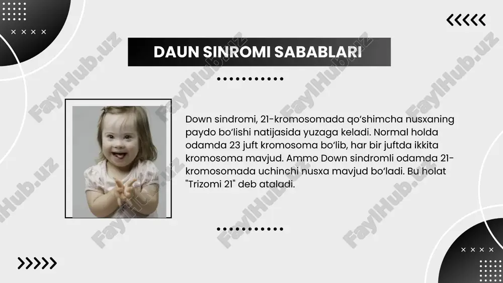 down sindromi - Page 2