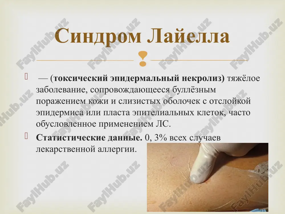 go soderjimogo) klinika porajenie slizistoy obolochki polosti rta, nachinayushegosya s aftoznogo i razvivayushegosya do nekrotichesko-yazvennogo stomatita porajenie polovix organov (vaginit, balanopostit) gemorragicheskiy (s perexodom v yazvenno-nekroticheskiy) kon'yunktivit — naibolee rannee proyavlenie zabolevaniya virajennaya obshaya simptomatika s narastayushey intoksikatsiey, vizvannoy poterey jidkosti i belka cherez porajyonnie erozirovannie poverxnosti, narusheniem vodno-solevogo balansa, razvitiem infektsionnix porajeniy (chasto pnevmoniy, vtorichnogo infitsirovaniya koji), krovotecheniem iz jkt vplot do letalnogo isxoda. klinika vajnimi diagnosticheskimi kriteriyami yavlyayutsya: • tyajeloe obshee sostoyanie bolnogo (visokaya temperatura, sputannost soznaniya i t.d.) • rezkaya boleznennost porajennoy i zdorovoy koji • polojitelniy simptom nikolskogo • simptom smochennogo belya • otsutstvie eozinofilii v klinicheskom analize krovi, uvelichenie kolichestva palochkoyadernix neytrofilov, toksicheskaya zernistost neytrofilov. diagnostika sindroma layela. taktika vedeniya bolnie podlejat obyazatelnoy gospitalizatsii v reanimatsionnoe otdelenie ili blok intensivnoy terapii bolnix vedut kak ojogovix (jelatelna «ojogovaya palatka») v maksimalno sterilnix usloviyax, chtobi ne dopustit ekzogennogo infitsirovaniya primenyaemie do razvitiya sindroma ls podlejat nemedlennoy otmene. …