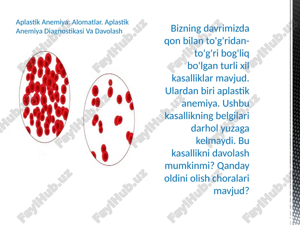 aydo bo‘lishi; aplastik – bolaning suyak ko‘migida jiddiy o‘zgarishlarga sabab bo‘ladigan va ko‘p hollarda o‘lim bilan tugaydigan holat, davolash juda qiyin; gipoplastik – suyak ko‘migining yengil darajada o‘zgarishi, yuqoridagilardan ko‘ra xavsizroq. umumiy ma'lumot aplastik anemiya - barcha qon hujayralari sonining keskin pasayishi kuzatiladigan, ammo o'sma jarayonining ochiq-oydin belgilari bo'lmagan gematopoetik tizimning kasalligi. mutaxassislarning fikricha, bu patologiya kam uchraydi. erkaklar ham, ayollar ham 50 yildan keyin tez-tez azob chekishi mumkin. o'z vaqtida davolash bo'lmasa, aplastik anemiya ko'pincha o'limga olib keladi. . kasallikning rivojlanish mexanizmi ma'lumki, hematopoez hujayralarning maxsus guruhi, ya'ni gematopoetik ildiz hujayralari orqali amalga oshiriladi. ular turli germatozoidlarga ko'payish va farqlash qobiliyatiga ega. ikkinchidan, etuk hujayralar (eritrotsitlar, lyukotsitlar, trombotsitlar va boshqalar) hosil bo'ladi. bir qator tashqi yoki ichki omillar ta'siri ostida kasallikning navbatdagi rivojlanishining quyidagi mexanizmlari mavjud: gematopoetik ildiz hujayralari soni asta-sekin kamayadi; ildiz hujayralarining asosiy funktsiyasi buziladi, bu eritrotsitlar, trombotsitlar va leykotsitlar hosil qilish qobiliyatini keltirib chiqarmaydi; bu holda …