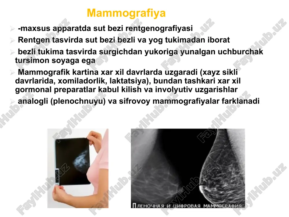 gli involyutsiya rentgen mammografiya sut bezi yullariga suvda eriydigan rentgen kontrast modda yuborgandan keyingi rentgen tamviri duktogrammada sut yullari va sinuslari anik konturga ega,tugrichizikli yul, sut yullari bushligi tekis duktografiya (galaktografiya) sut bezlari ultratovush tekshiruvi uz anatomiya: patologiya joylashuvini aniklash maksadida sut bezlari kuyidagiga bulinadi: surgich usti segment surgich osti segment surgich oldi kismi yukori tashki kvadrant pastki tashki kvadrant yukori ichki kvadrant sut bezi exogrammasi parenxima (markeri) sut yuli(strelka) sut bezi ultratovush tekshiruvi kukrakning morfologik tuzilishi xakida kuprok maʼlumot beradi. yukori chastotali tulkinlar orkali xar kanday xosilalar aniklanadi sut bezlari utt xayz sikli boshida utkaziladi, bu paytda sut bezlariga jinsiy gormonlar taʼsiri kam xisoblanadi utt da kushimcha tarzda sonoelastografiya funktsiyasi va boshkalardan foydalaniladi. sut bezlarining magnit rezonans tomografiyasi ko'pincha ularda turli xil neoplazmlarni, shuningdek tananing ushbu qismida patologiyani tashxislash uchun amalga oshiriladi ushbu usuldan foydalanish, hatto ziddiyatli holatlarda ham ishonchli tashxis qo'yish imkonini beradi. implantlarning holatini va yaxlitligini tekshirish …