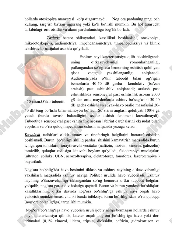 i; esnaganda,aksirganda eshitish qobiliyati qisqa vaqtga yaxshilanishini ta’kidlaydi. bemorning umumiy ahvoli o‘zgarmaydi, tana harorati me’yorda yoki subfebril bo‘ladi, qulog‘i og‘rimaydi. otoskopiyada nog‘ora pardani ichkariga botganligi va xiralashganligi; bolg‘acha dastasi kalta, tashqi o‘simtasi esa bo‘rtgan bo‘li ko‘rinadi, nog‘ora pardaning old va orqa burmalari ko‘zga tashlanib turadi. yorug‘lik konusi to‘g‘ri chiziq shaklida ko‘rinadi (me’yorda u uchburchak shaklda bo‘ladi). nog‘ora parda ichkariga yanada chuqur botgan hollarda yorug‘lik konusi ko‘rinmay qoladi (50-rasm). yallig‘lanish jarayoni eshituv nayidan nog‘ora bo‘shlig‘iga tarqalmagan hollarda otoskopiya manzarasi ko‘p o‘zgarmaydi. nog‘ora pardaning rangi och kulrang, sarg‘ish ba’zan jigarrang yoki ko‘k bo‘lishi mumkin. bu hol transudat tarkibidagi eritrotsitlar va ularni parchalanishiga bog‘lik bo‘ladi. tashxis bemor shikoyatlari, kasallikni boshlanishi, otoskopiya, mikrootoskopiya, audiometriya, impendansometriya, timpanopunksiya va klinik tekshiruvlar natijalari asosida qo‘yiladi. 50-rasm.o‘tkir tubootit eshituv nayi kateterizatsiya qilib tekshirilganda uning o‘tkazuvchanligi yomonlashganligi, puflangandan so‘ng esa bemorning eshitish qobiliyati qisqa vaqtga yaxshilanganligi aniqlanadi. audiometriyada o‘tkir tubootit bilan og‘rigan bemorlarda 40-50 db gacha konduktiv (ba’zan aralash) …