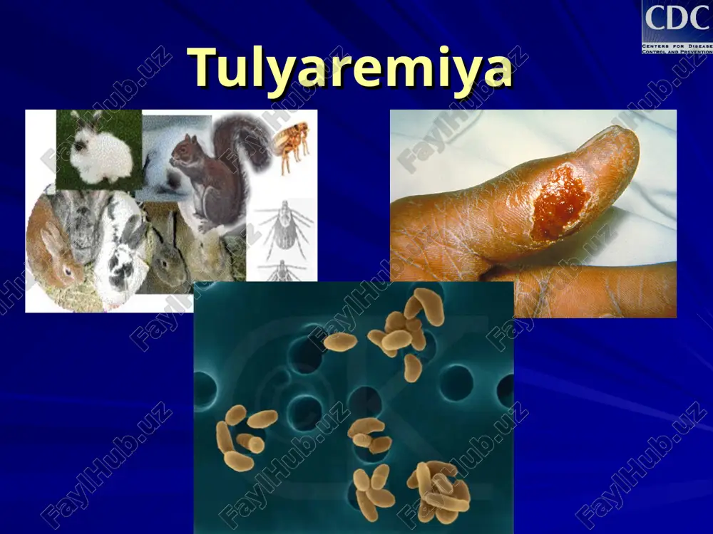vinlar va shu kabi qon so`ruvchi hashorotlarni chaqishi orqali epidemiologoyasi kasallikni yuqish yo`llari: alimentar - kasallik qo`zg’atuvchisi tushgan suv, oziq-ovqatlar (tulyaremiya bilan og’rigan hayvonning chala pishirilgan go`shti)ni iste`mol qilish orqali epidemiologiyasi kasallikni yuqish yo`llari: kontakt - kasallangan hayvonni so`yish yoki terisini shilishda, kasallik qo`zg’atuvchisi tushgan suvdà cho`milish, kir yuvish yoki daryoni kechib o`tishda teri va shilliq qavatlar orqali epidemiologiyasi kasallikni yuqish yo`llari: aspiratsion - kasallik qo`zg’atuvchisi tushgan chang bilan nafas olish orqali (o`t o`rish, em-xashak tayyorlash, sabzavotlarni yig’ish, don-dunlarni saranjomlash jarayonida) epidemiologiyasi kasallikni yuqish yo`llari: laborator sharoitlarda yuqish tulyaremiyaning har bir yuqish yo`liga ma`lum bir klinik shakli mos keladi: yuqish yo’li klinik shakli transmissiv yara-bubon shakli havo-tomchi o’pka yaki ko’z-bubon shakli alimentar og’iz-halqum (anginoz) yoki ichak shakli kontakt bubon shakli kasallik tashuvchilari - qon so`ruvchi hashorotlar kasallik manbai - quyon, sichqon, kalamushlar... francisella tularensis yarali bubon tomoq-halqum o’pkа a b c tulyaremiyaning yuqish yo`llari a = transmissiv b = kontakt …